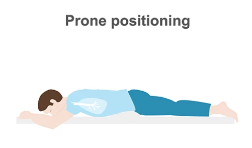 Prone Position