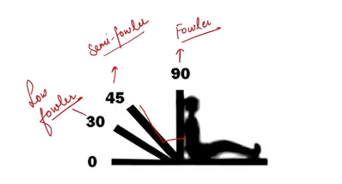 What are the possible patient positions on medical bed Fowler's position.png