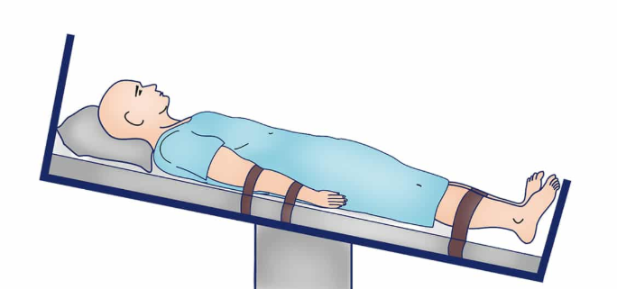 Reverse Trendelenburg Position