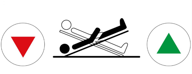 What are the possible patient positions on medical bed trendelenburg position and reverse trendelenburg position.png